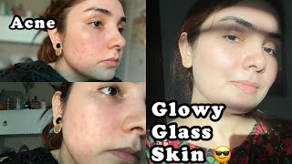 How i clear my acne  best Solution for glowy skin  Organic Glow [upl. by Ydnamron]