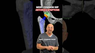 Early Hip Arthritis Symptoms 🦿shorts [upl. by Cindelyn188]