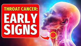 Dont Ignore 8 Early Warning Signs of Throat Cancer [upl. by Popper]