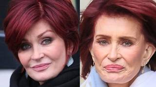 Worst Botched Celebrity Plastic Surgery Of 2024 You Cant Unsee [upl. by Ethel]