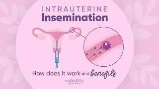 Intrauterine Insemination How Does It Work amp Benefits  The Fertility Center [upl. by Bannasch89]