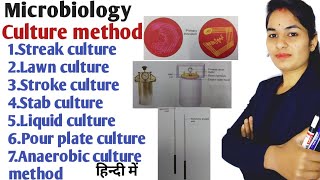 Culture method in hindi  Culture method in microbiology  Types of culture method microbiology [upl. by Brown]