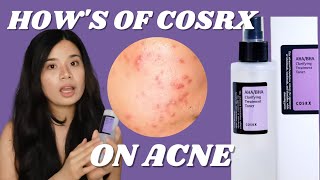 COSRX  How to Chemically Exfoliate using COSRX AHABHA Clarifying Treatment Toner  Sensitive Skin [upl. by Cutter]