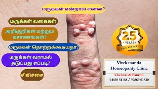 HPV warts மருக்களால் அவதிப்படுகிறீர்களா தீர்வு இதோ [upl. by Retep582]