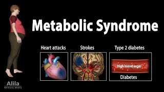 Metabolic Syndrome Animation [upl. by Deyes]