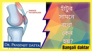 হাঁটু ব্যথা কেন হয়pain on climbing stairs or sitting for long time Anterior knee painDrprasenjit [upl. by Ahsrats]