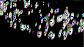 Herpesvirus Infection Increases Peroxisome Numbers [upl. by Brooke316]