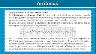 Arritmias Cardiacas 22  Clínica Médica Integral [upl. by Annaigroeg]