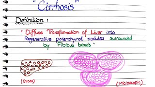 Cirrhosis of Liver  Pathology [upl. by Mavis718]