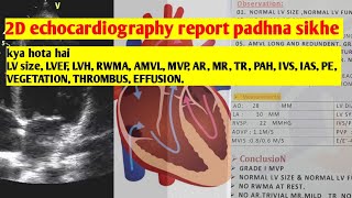 2D echocardiography ki report padhna sikhe [upl. by Zandra]