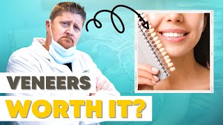 The Pros amp Cons of Dental Veneers  Are They Worth It [upl. by Holey691]