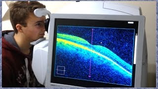 What is OCT Scanning Optical Coherence Tomography [upl. by Ahsiemal850]