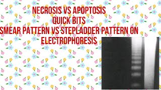 DIFFERENCE BETWEEN NECROSIS AND APOPTOSISWhat is Necrosis Vs What is Apoptosis [upl. by Timms]