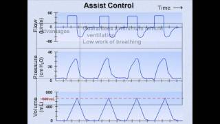 Ventilator Modes Mechanical Ventilation  Lecture 7 [upl. by Jennee]