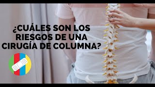 ¿Cuáles son los riesgos de una cirugía de columna [upl. by Newol]