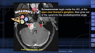 MedPix Video  Phakomatoses  Neurofibromatosis Type 2 Wishart Disease [upl. by Attikin]