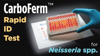 CarboFerm™ rapid carbohydrate test for Neisseria and Moraxella [upl. by Estren]