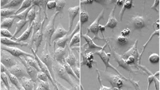 35Doxorubicin inhibits HeLa mitosys [upl. by Ardnosak]