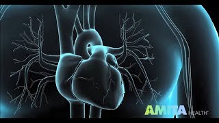 Coronary Angiography amp Cardiac Catheterization — AMITA Health [upl. by Anitsihc]