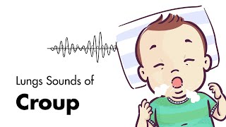 Sounds of Croup Laryngotracheitis  Lung Sounds  MEDZCOOL [upl. by Boycey]