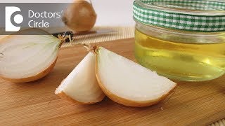 Time period required for hair regrowth after applying onion juice for hair loss  Dr Mini Nair [upl. by Jewelle]