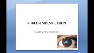 Ophthalmology 212 a PhacoEmulsification Surgery Extra Capsular Cataract Extraction [upl. by Atsirhc]