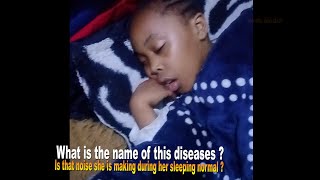 What is the name of this diseases Is that noise she is making during her sleeping normal [upl. by Sheldon]