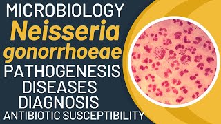 Neisseria gonorrhoeae pathogenesis  Gonorrhoea pathogenesis and microbiology [upl. by Froma]