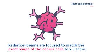 Radiotherapy Treatment Planning Process  Radiation Therapy  Manipal Hospitals India [upl. by Ellga]