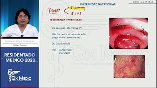 Cirugía general  3 Enfermedad diverticular [upl. by Lingwood]