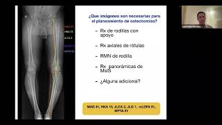 WEBINAR Osteotomías periarticulares en RODILLA [upl. by Eidorb]