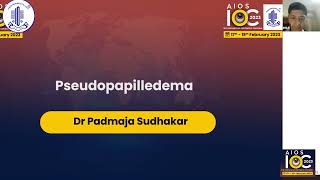 Pseudopapilledema  Dr Padmaja Sudhakar [upl. by Adnarym322]