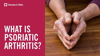 What Is Psoriatic Arthritis [upl. by Elleinwad]