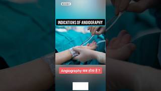 Uses Of Angiography [upl. by Orabel628]