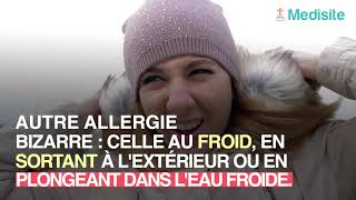 Les allergies les plus rares et bizarres [upl. by Airdnal]