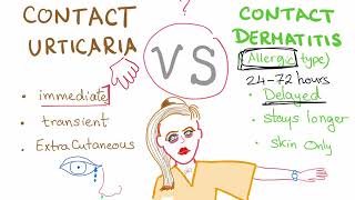 Contact Urticaria vs Contact Dermatitis [upl. by Box]