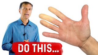 Raynauds Syndrome – What Can you do for Raynauds Syndrome – DrBerg [upl. by Eislel]