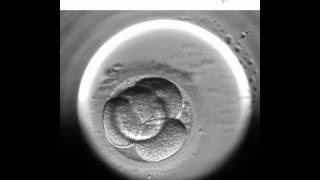 Embryoscope 1  Nuevo método de cultivo y selección embrionaria [upl. by Coonan]