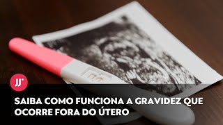 Gravidez fora do útero tem sintomas semelhantes à gestação normal saiba o tratamento [upl. by Notsahc]