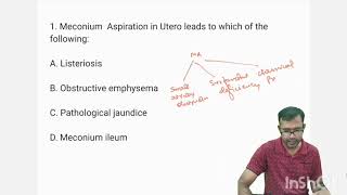 Neonatology MCQTopic 1 MECONIUM ASPIRATION SYNDROME mcq newborn education neet [upl. by Brightman]