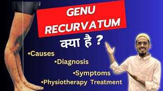 Genu recurvatum in Hindi  Causes  Diagnosis  Medical Treatment  Physiotherapy Treatment [upl. by Einhapets]