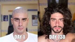 Two years time lapse of hair growth [upl. by Drof]