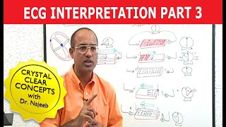 EKG or ECG Interpretation  Part 320 [upl. by Oriaj166]