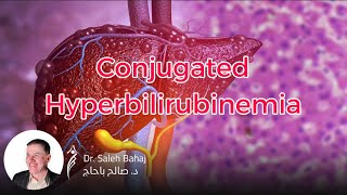 4 Conjugated Hyperbilirubinemia [upl. by Idieh]