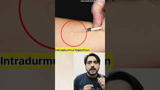 Intradurmul Injection क्या हैं youtubeshorts doctor medical [upl. by Aserehtairam216]