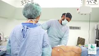 Vaser Liposuction Ameliyatı İzle  Flora Klinik [upl. by Ennazzus]