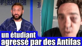 Un étudiant Agressé par des Antifas dans son université 😡 le Tshirt anti J  UIF 🤦‍ TPMP réaction [upl. by Marella]