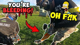 PAINTBALL FUNNY MOMENTS amp FAILS ► INJURIES IN PAINTBALL 😱 [upl. by Chloette172]