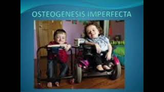 Osteogenesis imperfecta mrcpch Clinical [upl. by Enael458]