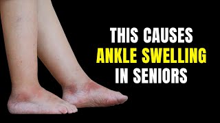 5 Causes Of Swollen Ankles In Seniors [upl. by Gerhardt847]